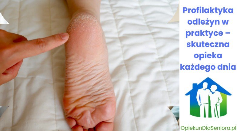 Profilaktyka odleżyn w praktyce – skuteczna opieka każdego dnia